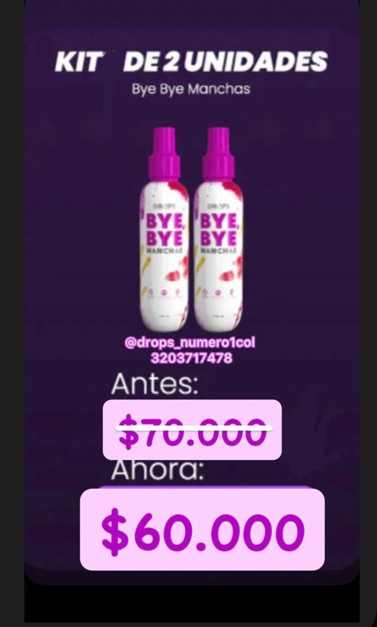 Customer photo review of BYE BYE Manchas Quitamanchas 250ml