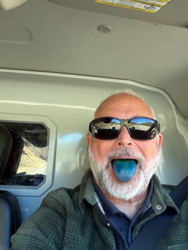 Customer showing their tongue stained blue after taking the Meraki Blu Methylene Blue.