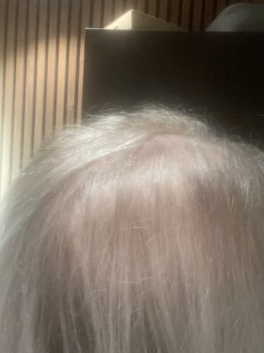 Customer shows a close-up of their thin, white hair before using Grey Cover.