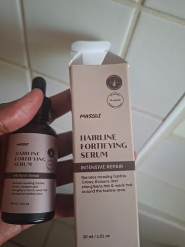 Customer photo review of New Formula: Hairline Fortifying Serum 30ml