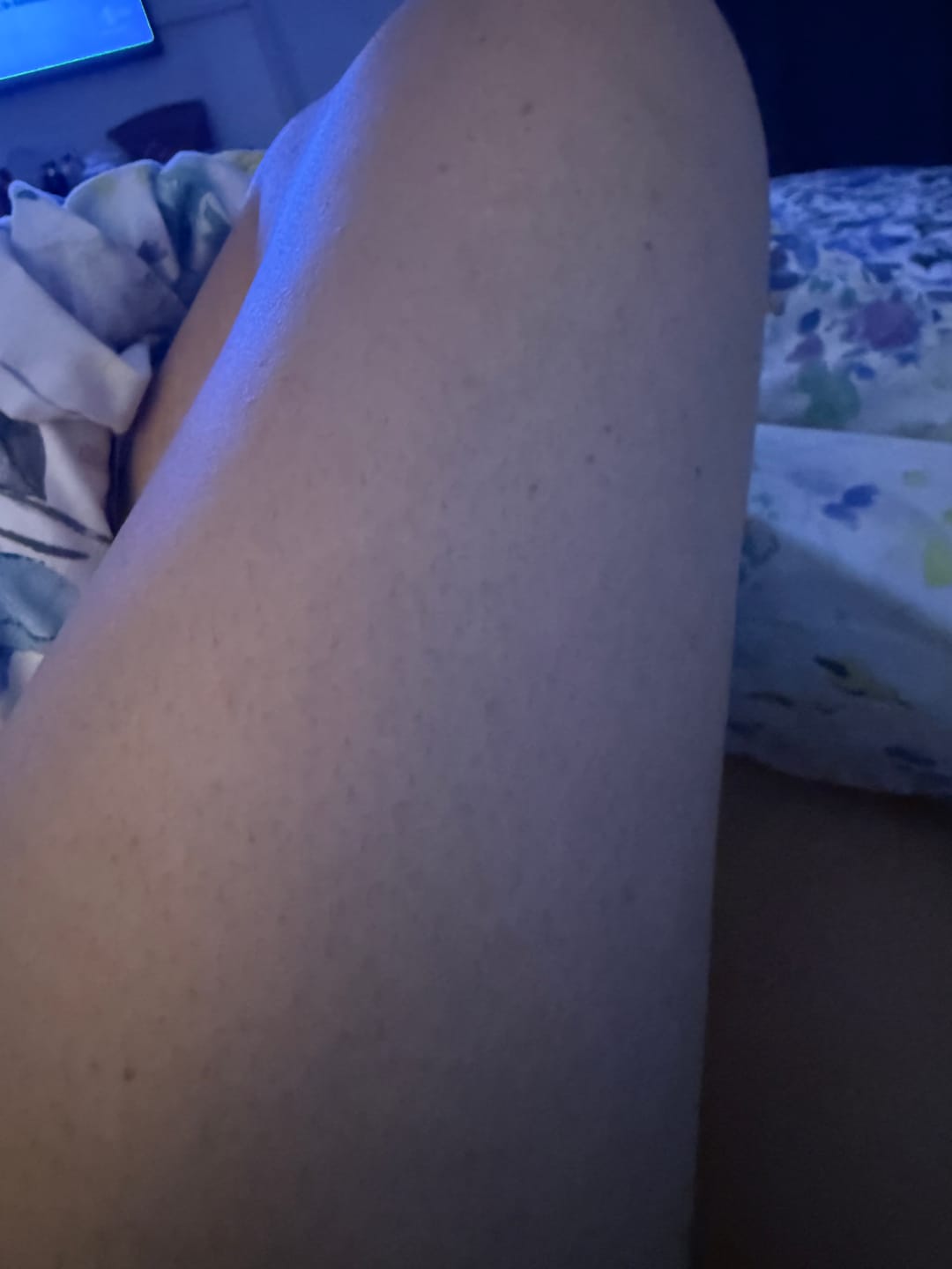 Customer photo review of Crema lifting corpo