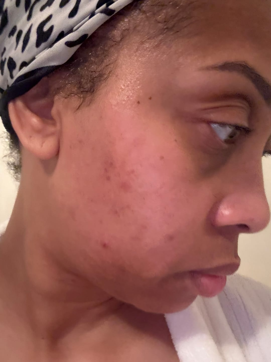 Customer photo review of Exfoliating Soap