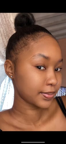 Customer photo review of Minoxidil5% Solution, 1 Pack 60ml