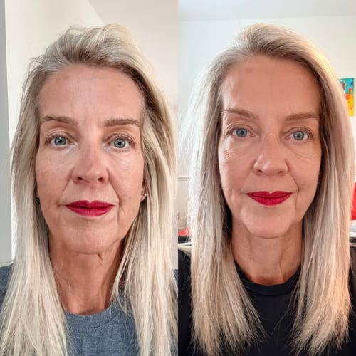 Reviewer's before-and-after photo showing diminished fine lines and smoother skin after using the Freedom Face Whip.