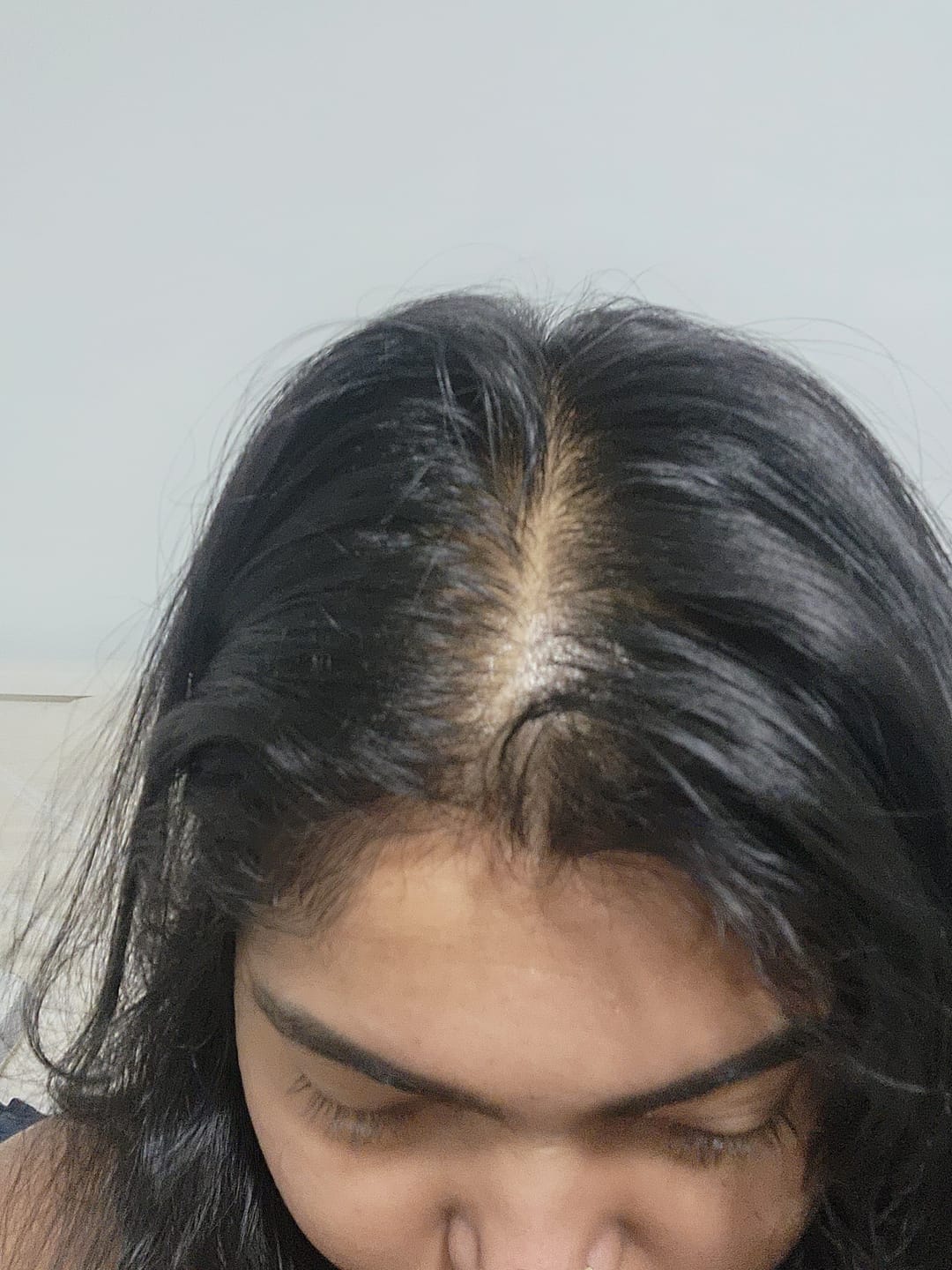 Customer photo review of Hair Loss Prevention Kit