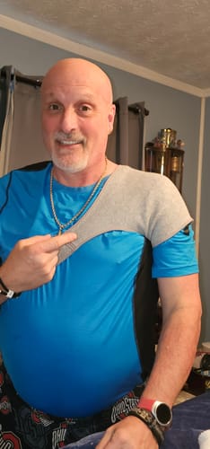 Customer photo review of Premium Bamboo Shoulder Brace