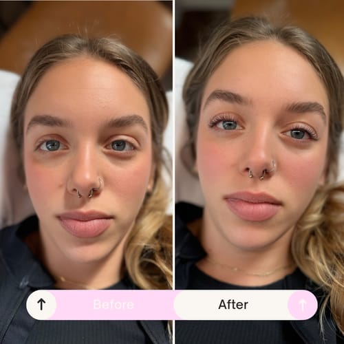 Customer photo review of Pure Care Lash & Brow Lift Pack
