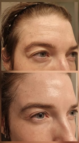 Customer photo review of TV-Set 3 I Serum + Lifting Creme