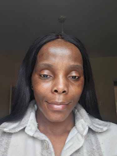 Close-up of a reviewer's face, showing smooth skin results from using the 5-Step Clear Skin Kit.