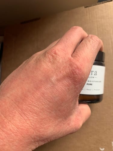 Customer photo review of Fera Tallow Pure Whipped Tallow - Grass-Fed Fragrance-Free Moisturiser