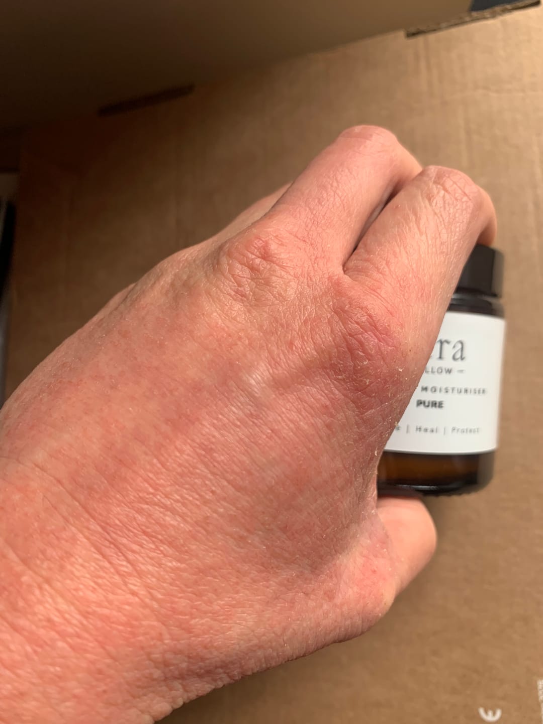 Customer photo review of Fera Tallow Pure Whipped Tallow - Grass-Fed Fragrance-Free Moisturiser