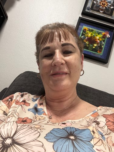 Customer's 'before' photo showing her skin prior to using the Grass Fed Tallow & Honey Balm.