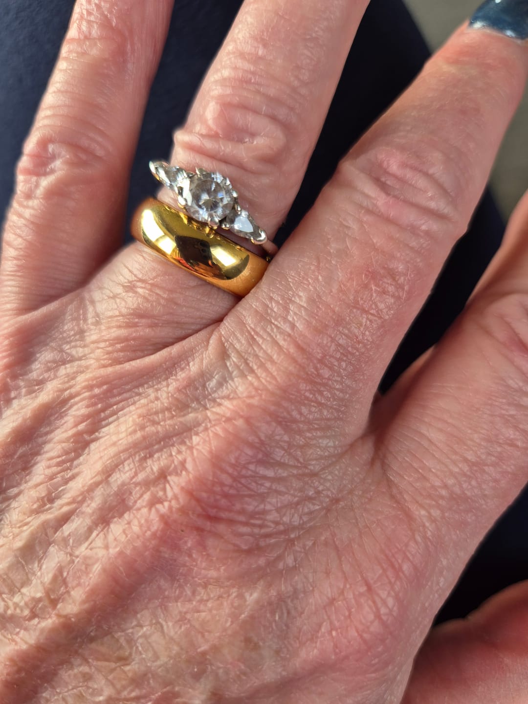 Customer photo review of Gold Wonder Ring Set