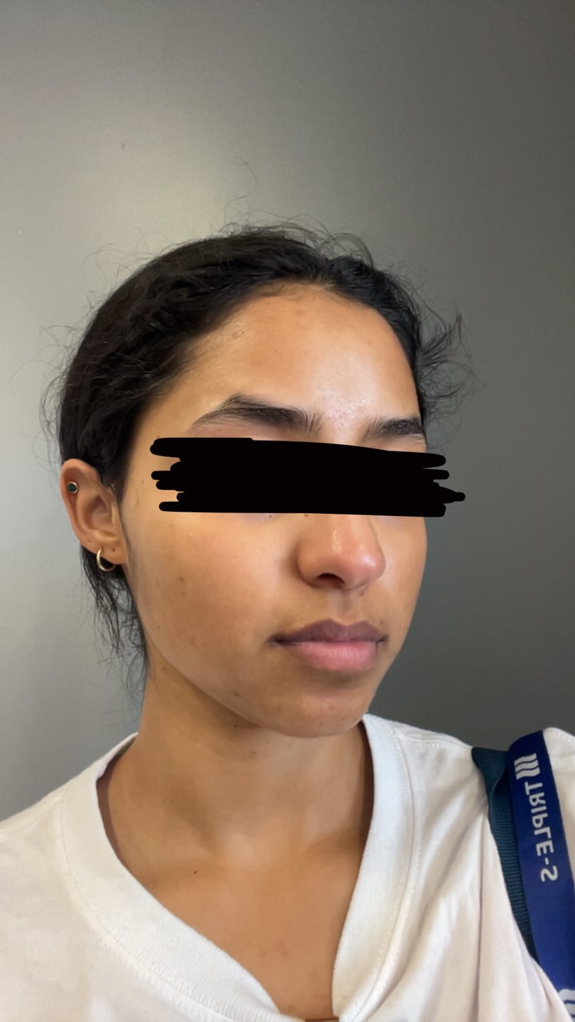 Customer photo review of Top-to-Toe SPF Veil SPF 50+/PA++++