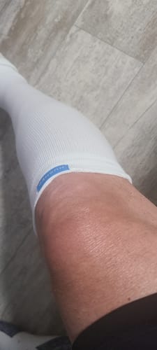 Close-up of a reviewer's leg wearing the white Performance Eucalyptus Compression Sock.