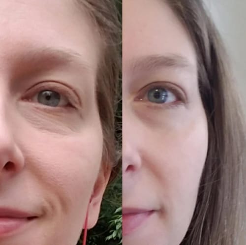 Customer photo review of Hyaluronic Acid Ultra Hydrating Serum