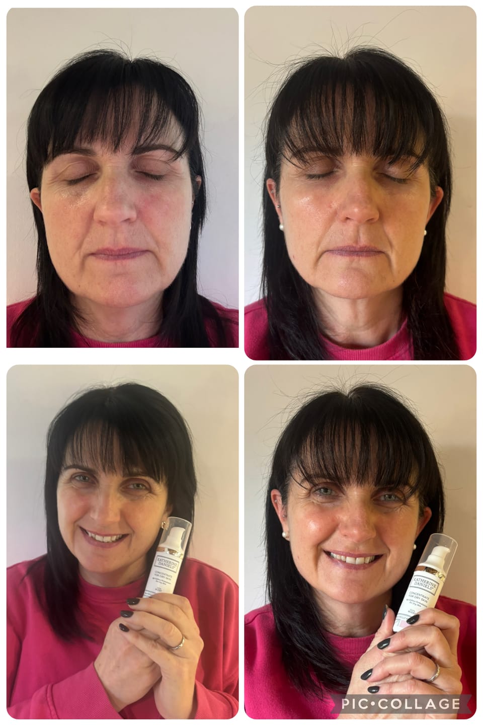 Customer photo review of Concentrate for Dry Skin
