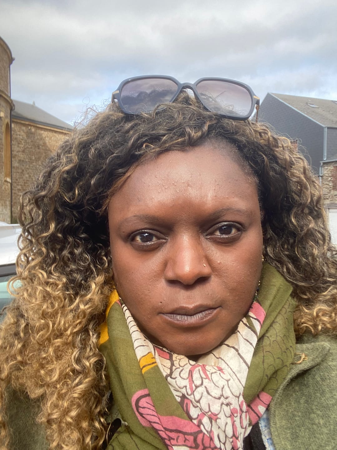 Customer photo review of Lemonvate Brightening Gel 30g