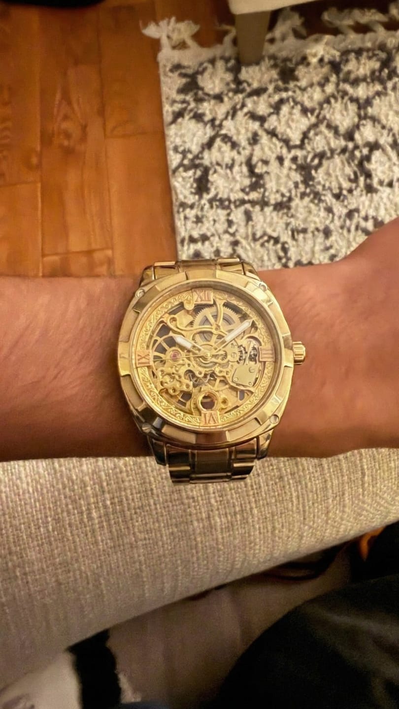 Customer photo review of STERLINGX - Transparent