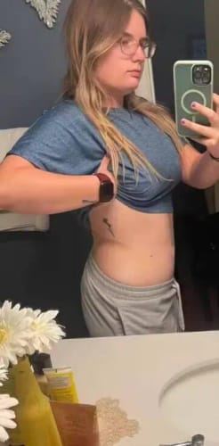 Customer photo review of Dopamine Energy Patches
