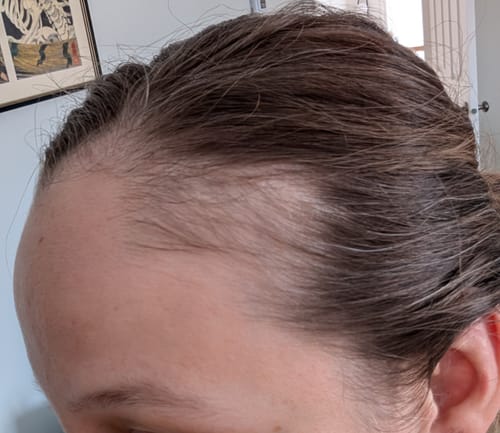 Customer photo review of Pre-Wash Scalp Oil by TR