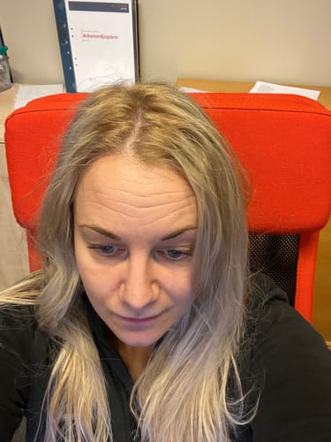 A reviewer shows her hair with golden roots after using the Sunkissed Refill to lighten her regrowth.