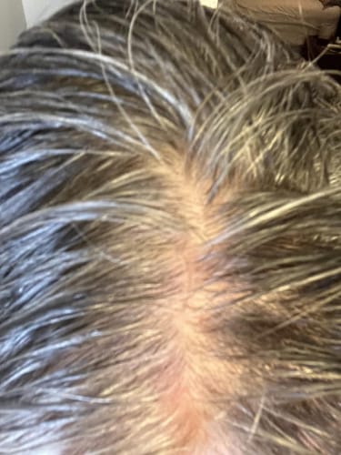 Customer photo review of SHAMPOING NATUREL AU ROMARIN ET À LA KÉRATINE — POUR DES CHEVEUX PLUS ÉPAIS ET PLUS VOLUMINEUX