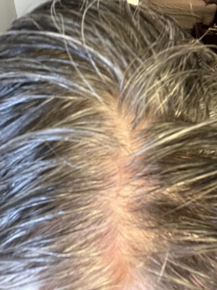 Customer photo review of SHAMPOING NATUREL AU ROMARIN ET À LA KÉRATINE — POUR DES CHEVEUX PLUS ÉPAIS ET PLUS VOLUMINEUX