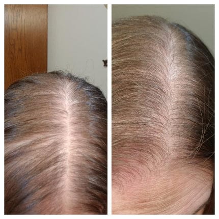 Customer photo review of SHAMPOING NATUREL AU ROMARIN ET À LA KÉRATINE — POUR DES CHEVEUX PLUS ÉPAIS ET PLUS VOLUMINEUX