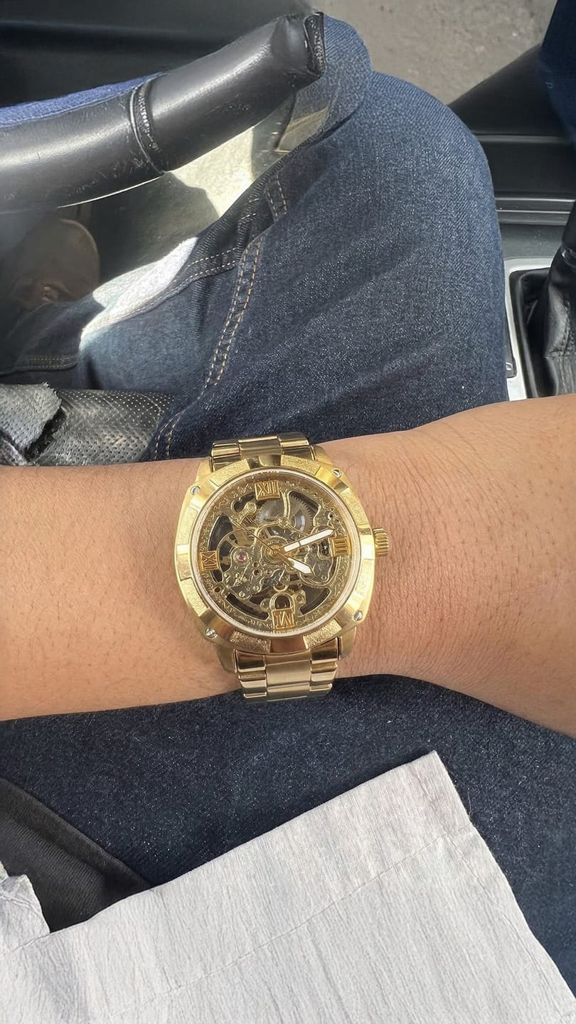 Customer photo review of STERLINGX - Transparent