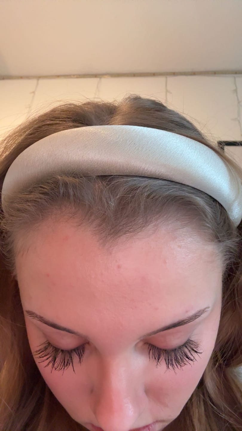 Customer photo review of HAIRCOCA!NE - Haarserum
