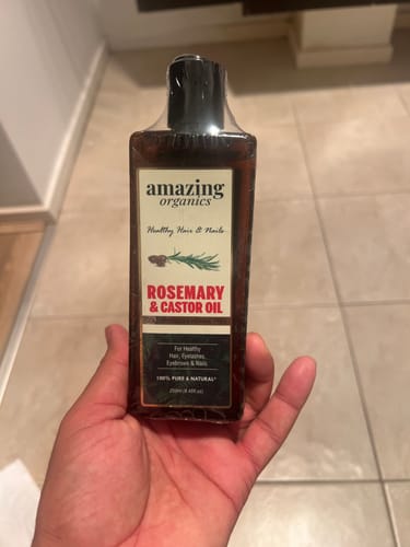 Customer photo review of Rosemary & Castor Hair Oil - Grow hair 20X faster