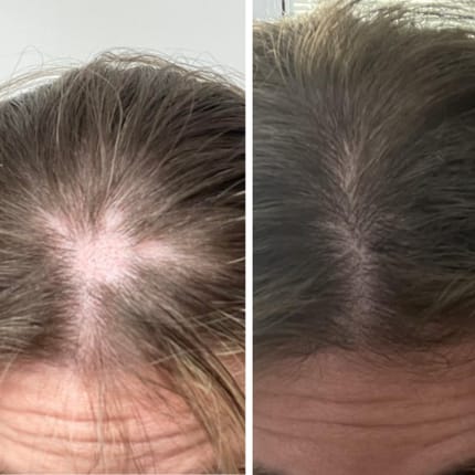 Customer photo review of SHAMPOING NATUREL AU ROMARIN ET À LA KÉRATINE — POUR DES CHEVEUX PLUS ÉPAIS ET PLUS VOLUMINEUX