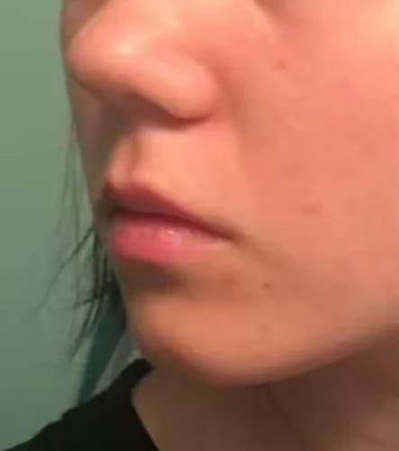Customer photo review of Calcium Volume Multi Balm
