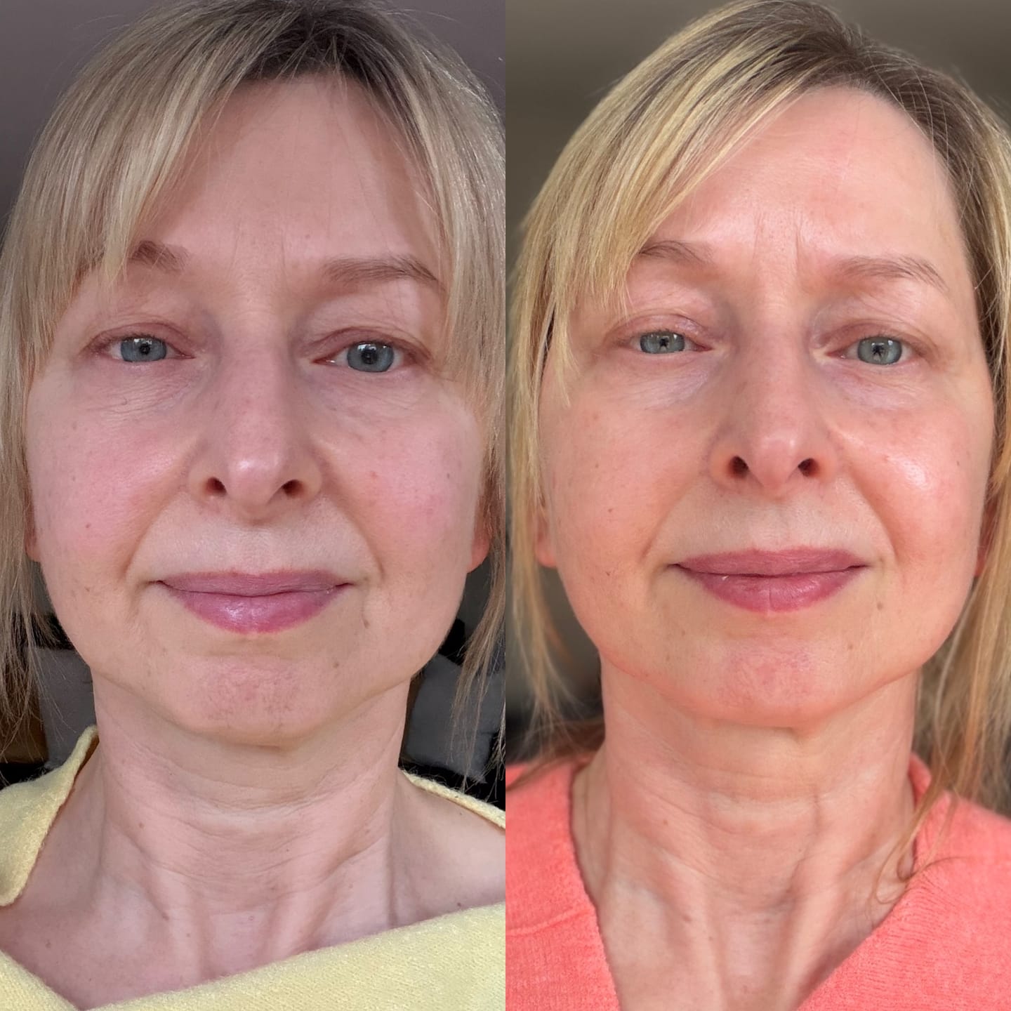 Customer photo review of Concentrate for Dry Skin
