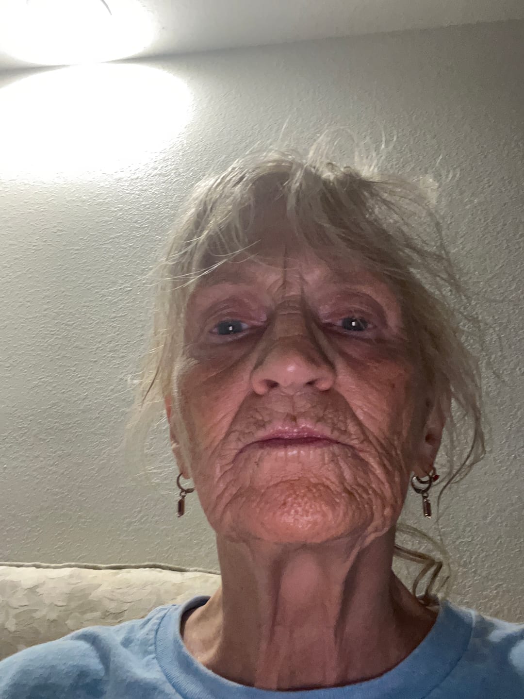 Customer photo review of Anti-Aging SPF 30 Moisturizing Cream