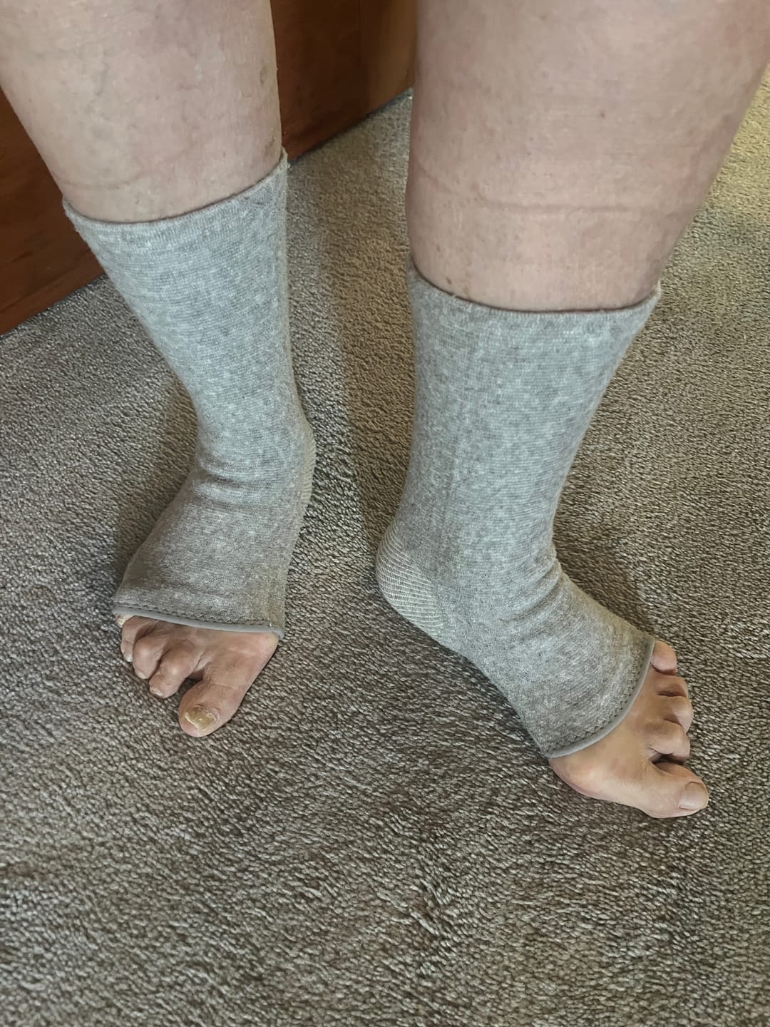 Customer photo review of Premium Anti-Fatigue Bamboo Footsleeves