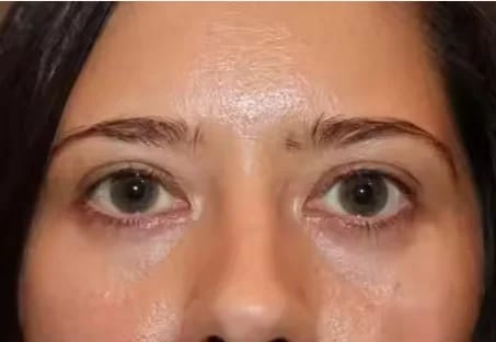 Customer photo review of Calcium Volume Multi Balm