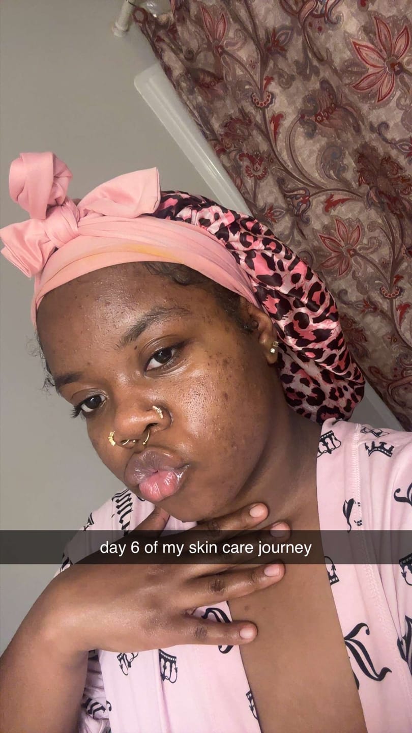 Customer photo review of Turmeric and Kojic Foaming Face Wash