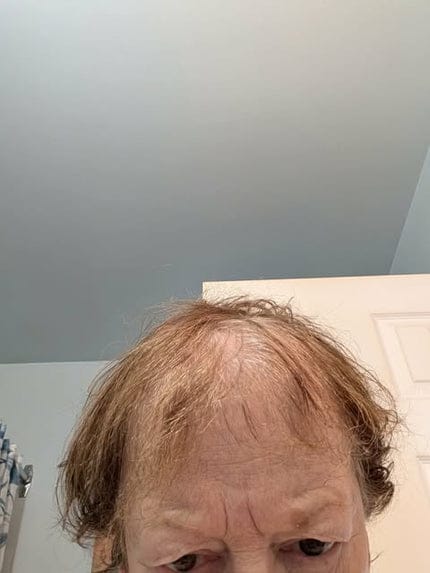 Customer photo review of SHAMPOING NATUREL AU ROMARIN ET À LA KÉRATINE — POUR DES CHEVEUX PLUS ÉPAIS ET PLUS VOLUMINEUX