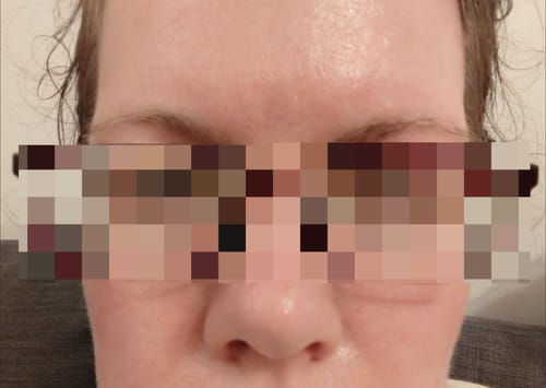 Customer photo review of Seb Natural Soothing Balm
