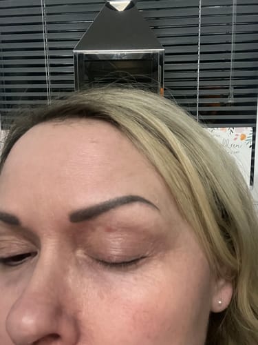 Customer photo review of Seb Natural Calming Serum