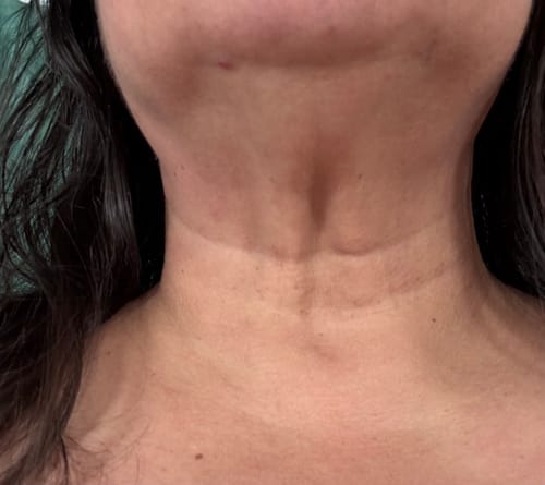 Customer photo review of [Centellian24] Madeca Cream Time Reverse 50ml