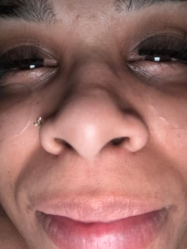 Customer photo review of Transform Wrinkles, Fine Lines, And Tired Creases Naturally