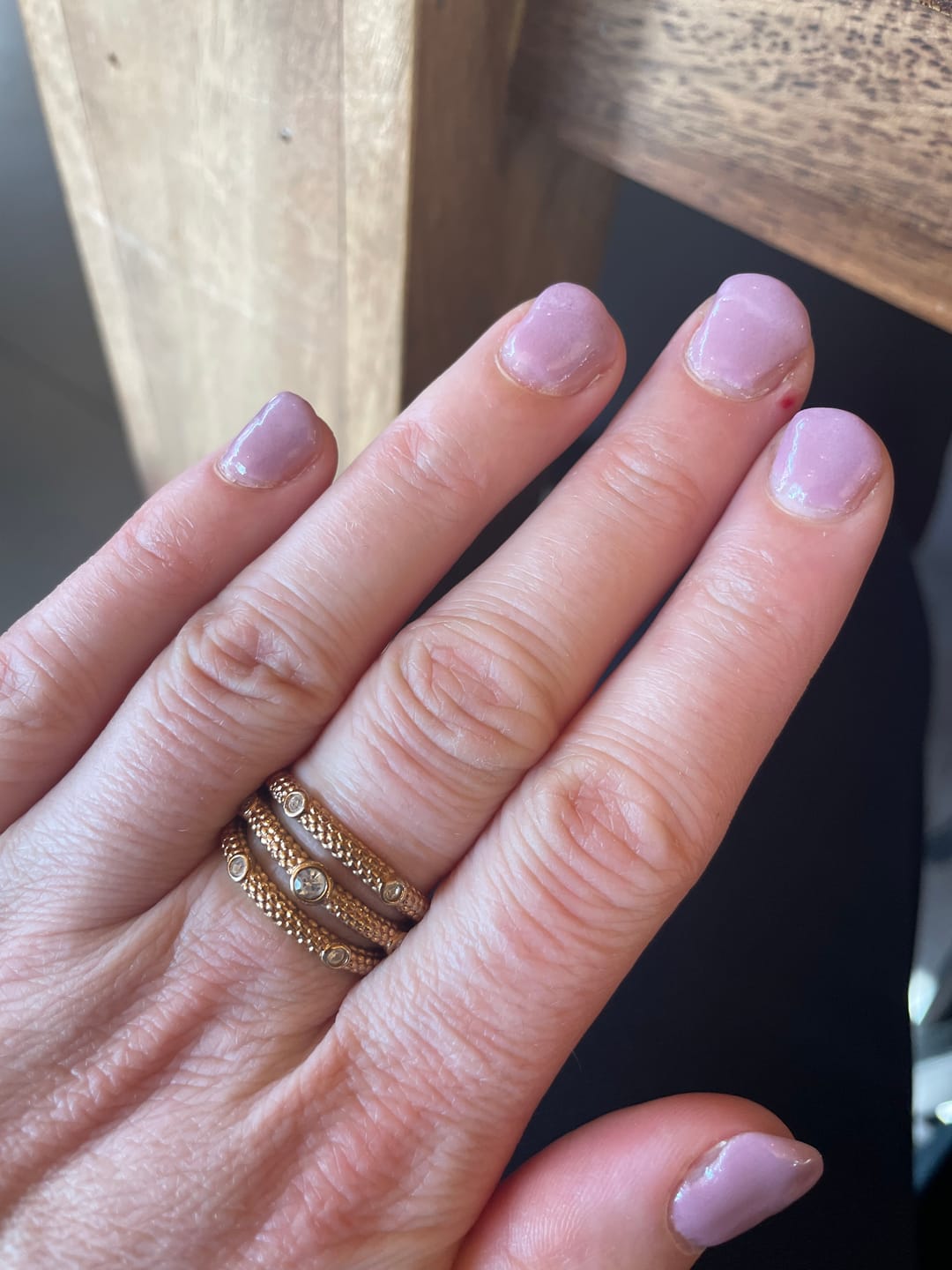 Customer photo review of Verwijderkom