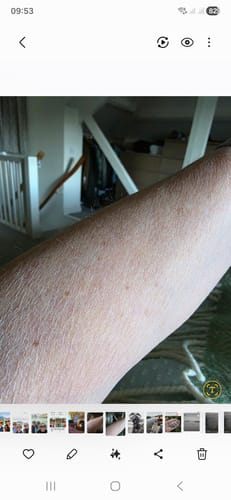 Customer photo review of Besque® Magic Body Oil XL - 200ml