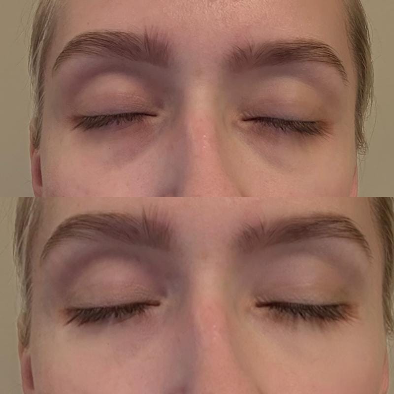 Customer photo review of Labbok Eye Cream dark circles puffiness, 20ml