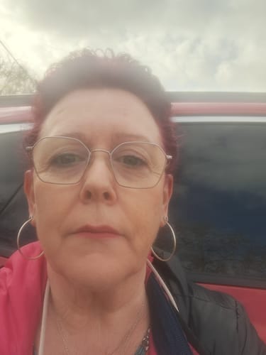 Customer photo review of Serum Arrugas y Flacidez  TULUM