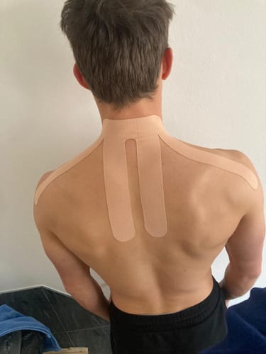 Kundenbewertung mit Foto zu TAPEX™ - Nacken
