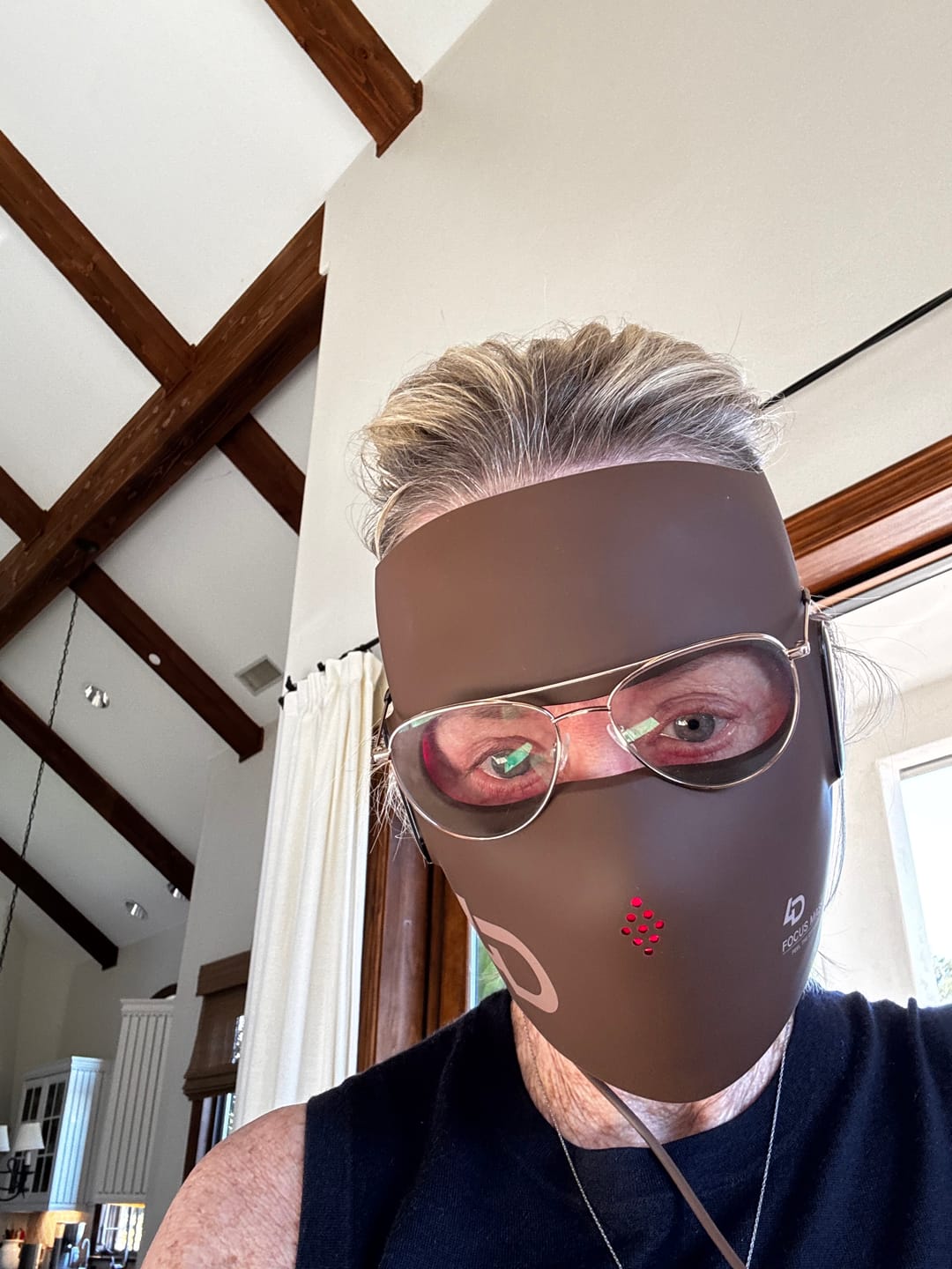 Customer photo review of JOVS 4D Laser Anti-Aging Therapy Mask